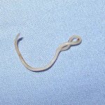 Appearance of cat roundworm
